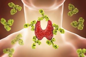 Hashimoto-Thyreoiditis - Ursachen - Symptome - Diagnose und Behandlung Hashimoto-Thyreoiditis - Ursachen - Symptome - Diagnose und Behandlung